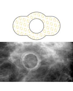 Spee-D-Ring™ Mammography Mole Skin Marker, 100 per Box