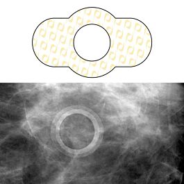 Spee-D-Mark CT Scan Skin Markers